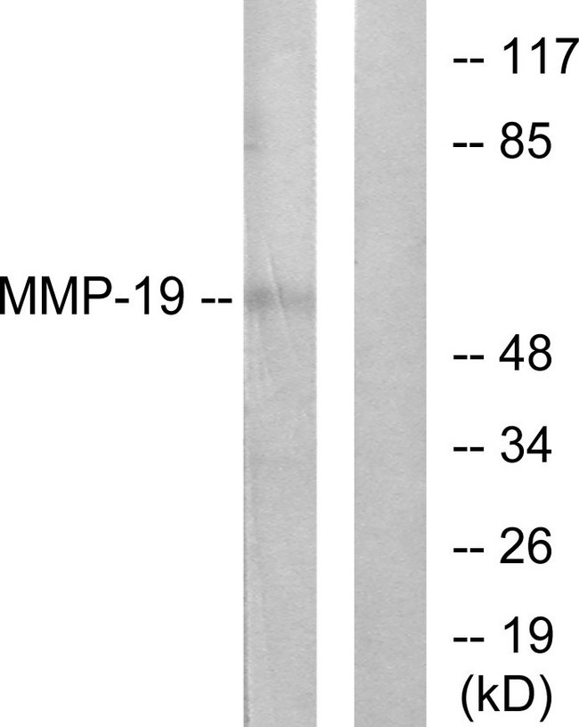 MMP19 Antibody - Western blot analysis of lysates from HUVEC cells, using MMP-19 Antibody. The lane on the right is blocked with the synthesized peptide.