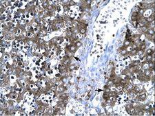 MMP19 Antibody - MMP19 antibody ARP32315_T100-NP_002420-MMP19 (matrix metallopeptidase 19) Antibody was used in IHC to stain formalin-fixed, paraffin-embedded human liver.  This image was taken for the unconjugated form of this product. Other forms have not been tested.