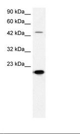 MMP19 Antibody - HepG2 Cell Lysate.  This image was taken for the unconjugated form of this product. Other forms have not been tested.