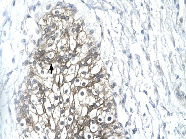 MMP19 Antibody - Human Urinary bladder.  This image was taken for the unconjugated form of this product. Other forms have not been tested.