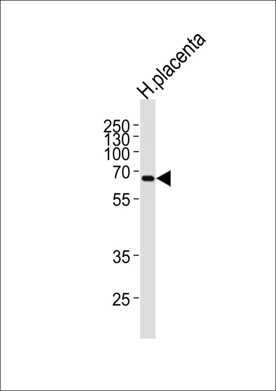 MMP19 Antibody - Western blot of lysate from human placenta tissue lysate, using MMP19 Antibody. Antibody was diluted at 1:1000 at each lane. A goat anti-rabbit IgG H&L (HRP) at 1:5000 dilution was used as the secondary antibody. Lysate at 35ug per lane.