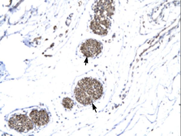 MMP19 Antibody - Human Urinary bladder.  This image was taken for the unconjugated form of this product. Other forms have not been tested.
