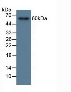 MMP19 Antibody - Western Blot; Sample: Human Blood Cells.