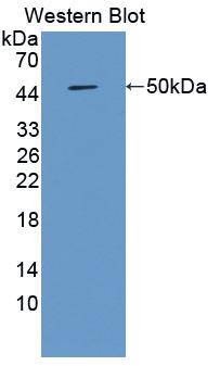 MMP19 Antibody - Western blot of MMP19 antibody.