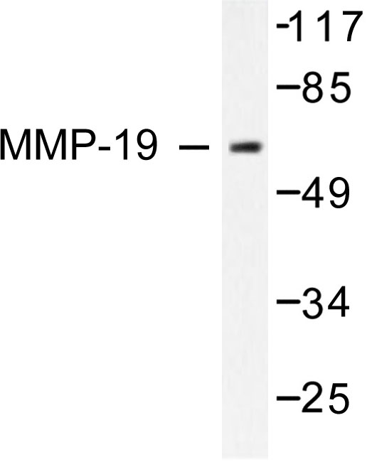 MMP19 Antibody - Western blot of MMP-19 (G44) pAb in extracts from HUVEC cells.