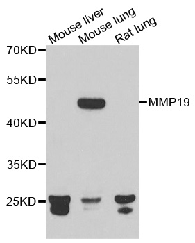 MMP19 Antibody - Western blot analysis of extracts of various cell lines.