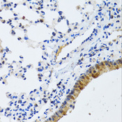 MMP19 Antibody - Immunohistochemistry of paraffin-embedded rat lung tissue.