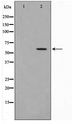 MMP19 Antibody - Western blot of HUVEC cell lysate using MMP19 Antibody