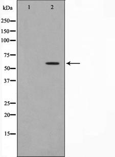 MMP19 Antibody - Western blot analysis on HuvEc cell lysates using MMP19 antibody. The lane on the left is treated with the antigen-specific peptide.