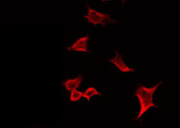 MMP19 Antibody - Staining HuvEc cells by IF/ICC. The samples were fixed with PFA and permeabilized in 0.1% Triton X-100, then blocked in 10% serum for 45 min at 25°C. The primary antibody was diluted at 1:200 and incubated with the sample for 1 hour at 37°C. An Alexa Fluor 594 conjugated goat anti-rabbit IgG (H+L) Ab, diluted at 1/600, was used as the secondary antibody.