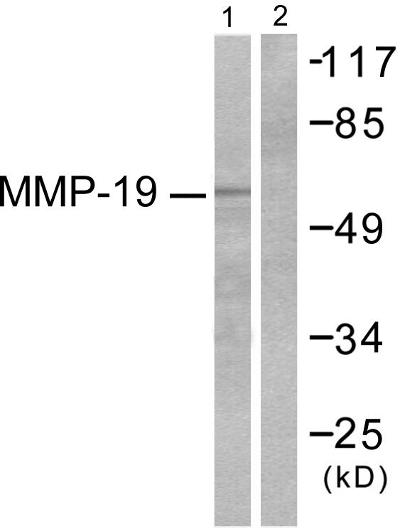 MMP19 Antibody - Western blot analysis of extracts from HuvEc cells, using MMP-19 antibody.