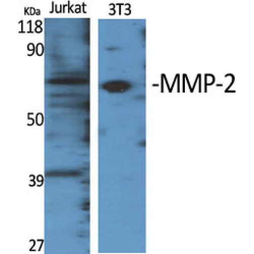 MMP2 Antibody - Western blot of MMP-2 antibody