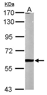 MMP2 Antibody - Sample (50 ug of whole cell lysate). A: Mouse brain. 7.5% SDS PAGE. MMP-2 antibody diluted at 1:1000.