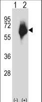 MMP2 Antibody - Western blot of MMP2 (arrow) using rabbit polyclonal MMP2 Antibody. 293 cell lysates (2 ug/lane) either nontransfected (Lane 1) or transiently transfected (Lane 2) with the MMP2 gene.
