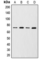MMP2 Antibody - Western blot analysis of MMP2 expression in HUVEC (A); NRK (B); MCF7 (C); HT1080 (D) whole cell lysates.