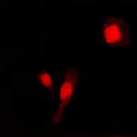MMP2 Antibody - Immunofluorescent analysis of MMP2 staining in COLO205 cells. Formalin-fixed cells were permeabilized with 0.1% Triton X-100 in TBS for 5-10 minutes and blocked with 3% BSA-PBS for 30 minutes at room temperature. Cells were probed with the primary antibody in 3% BSA-PBS and incubated overnight at 4 C in a humidified chamber. Cells were washed with PBST and incubated with a DyLight 594-conjugated secondary antibody (red) in PBS at room temperature in the dark. DAPI was used to stain the cell nuclei (blue).