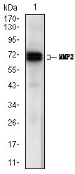 MMP2 Antibody - Western blot using MMP2 mouse monoclonal antibody against A431 (1) cell lysate.