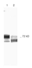 MMP2 Antibody - 1: Human Recombinant MMP-2 2: Schwann Cell Culture Medium electroblot to nitrocellulose slot blot immunolabeling 1?Ab: Matrix Metalloproteinase-2 antibody (MMP-2) [MMP2/2C1] 2?Ab: anti-mouse-biotin Detection: avidin-HRP Chromagen: DAB/H202.  This image was taken for the unconjugated form of this product. Other forms have not been tested.
