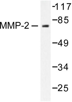 MMP2 Antibody - Western blot of MMP-2 (L638) pAb in extracts from LOVO cells.