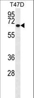 MMP2 Antibody - Western blot of MMP2 Antibody in T47D cell line lysates (35 ug/lane). MMP2 (arrow) was detected using the purified antibody.(1:200)