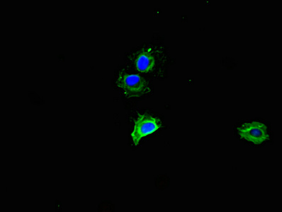 MMP2 Antibody - Immunofluorescent analysis of Hela cells using MMP2 Antibody at dilution of 1:100 and Alexa Fluor 488-congugated AffiniPure Goat Anti-Rabbit IgG(H+L)