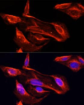 MMP2 Antibody - Immunofluorescence analysis of U2OS cells using MMP2 antibody at dilution of 1:100. Blue: DAPI for nuclear staining.