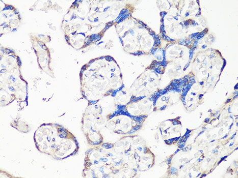 MMP2 Antibody - Immunohistochemistry of paraffin-embedded human placenta using MMP2 Antibody at dilution of 1:100 (40x lens).