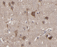 MMP2 Antibody - 1/100 staining human brain tissue by IHC-P. The sample was formaldehyde fixed and a heat mediated antigen retrieval step in citrate buffer was performed. The sample was then blocked and incubated with the antibody for 1.5 hours at 22°C. An HRP conjugated goat anti-rabbit antibody was used as the secondary antibody.