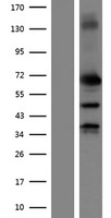 MMP2 Protein - Western validation with an anti-DDK antibody * L: Control HEK293 lysate R: Over-expression lysate