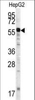 MMP20 Antibody - Western blot of anti-MMP20 Antibody in HepG2 cell line lysates (35 ug/lane). MMP20 (arrow) was detected using the purified antibody.