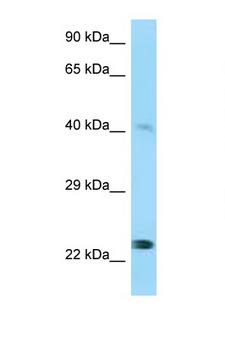 MMP20 Antibody - MMP20 antibody Western blot of 721_B Cell lysate. Antibody concentration 1 ug/ml. This image was taken for the unconjugated form of this product. Other forms have not been tested.