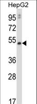 MMP20 Antibody - MMP20 Antibody western blot of HepG2 cell line lysates (35 ug/lane). The MMP20 antibody detected the MMP20 protein (arrow).
