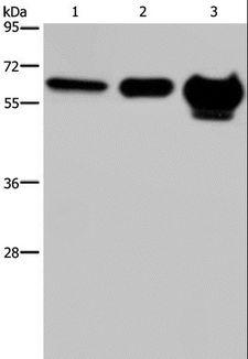 MMP20 Antibody - Western blot analysis of 823 cell, mouse brain and human fetal brain tissue, using MMP20 Polyclonal Antibody at dilution of 1:400.