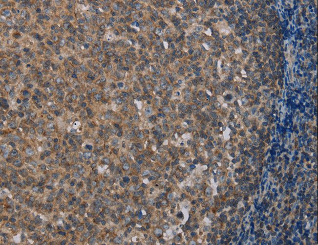 MMP20 Antibody - Immunohistochemistry of paraffin-embedded Human tonsil using MMP20 Polyclonal Antibody at dilution of 1:40.