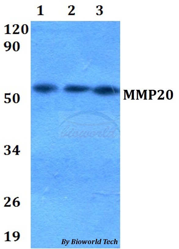 MMP20 Antibody - Western blot of MMP20 antibody at 1:500 dilution. Lane 1: HEK293T whole cell lysate. Lane 2: Raw264.7 whole cell lysate. Lane 3: PC12 whole cell lysate.