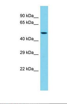 MMP21 Antibody - Western blot of Mouse Liver. Mmp21 antibody dilution 1.0 ug/ml.  This image was taken for the unconjugated form of this product. Other forms have not been tested.