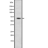 MMP21 Antibody - Western blot analysis of MMP21 using COS7 whole lysates.