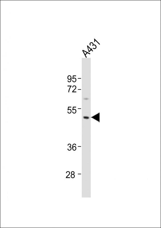 MMP23 Antibody - Anti-MMP23A Antibody (C-Term)at 1:1000 dilution + A431 whole cell lysates Lysates/proteins at 20 ug per lane. Secondary Goat Anti-Rabbit IgG, (H+L), Peroxidase conjugated at 1:10000 dilution. Predicted band size: 44 kDa. Blocking/Dilution buffer: 5% NFDM/TBST.