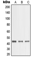 MMP23 Antibody - Western blot analysis of MMP23 expression in A431 (A); A375 (B); HeLa (C) whole cell lysates.
