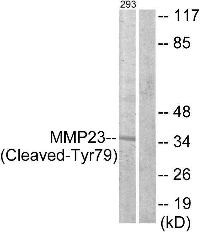 MMP23 Antibody - Western blot analysis of extracts from 293 cells, treated with etoposide (25uM, 1hour), using MMP23 (Cleaved-Tyr79) antibody.