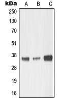 MMP23 Antibody - Western blot analysis of MMP23 expression in HepG2 (A); mouse kidney (B); rat kidney (C) whole cell lysates.