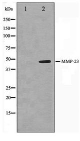 MMP23 Antibody - Western blot of SK-OV3 cell lysate using MMP23 Antibody