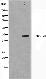 MMP23 Antibody - Western blot analysis on SK-OV3 cell lysates using MMP23 antibody. The lane on the left is treated with the antigen-specific peptide.