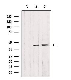 MMP23 Antibody - Western blot analysis of extracts of various samples using MMP23 antibody. Lane 1: HeLa treated with blocking peptide. Lane 2: HeLa; Lane 3: HepG2;
