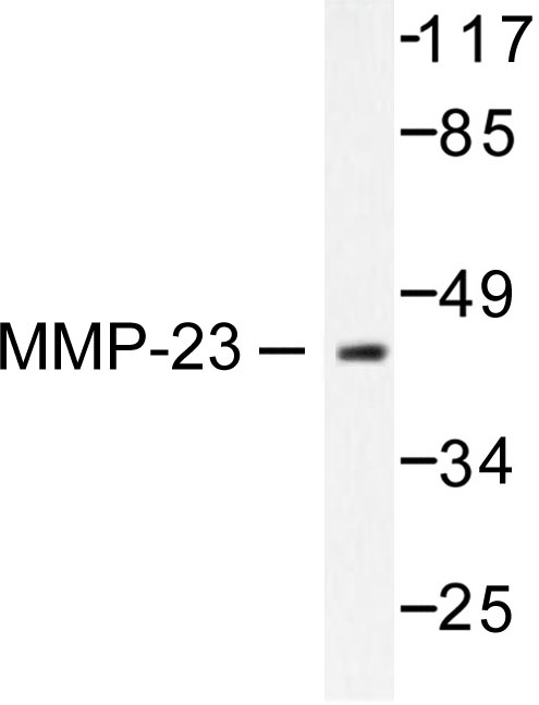 MMP23 Antibody - Western blot of MMP-23 (V371) pAb in extracts from SKOV3 cells.