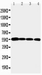 MMP24 Antibody - WB of MMP24 / MMP-24 antibody. Lane 1: PANC Cell Lysate. Lane 2: HELA Cell Lysate. Lane 3: SMMC Cell Lysate. Lane 4: A549 Cell Lysate.