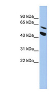 MMP24 Antibody - MMP24 antibody Western blot of HepG2 cell lysate. This image was taken for the unconjugated form of this product. Other forms have not been tested.