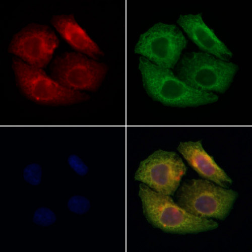 MMP24 Antibody - Staining HeLa cells by IF/ICC. The samples were fixed with PFA and permeabilized in 0.1% Triton X-100, then blocked in 10% serum for 45 min at 25°C. Samples were then incubated with primary Ab(1:200) and mouse anti-beta tubulin Ab(1:200) for 1 hour at 37°C. An AlexaFluor594 conjugated goat anti-rabbit IgG(H+L) Ab(1:200 Red) and an AlexaFluor488 conjugated goat anti-mouse IgG(H+L) Ab(1:600 Green) were used as the secondary antibod