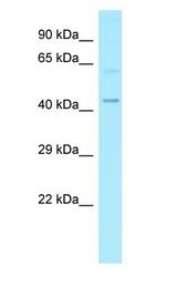 MMP25 / Leukolysin Antibody - MMP25 / Leukolysin antibody Western Blot of HeLa.  This image was taken for the unconjugated form of this product. Other forms have not been tested.