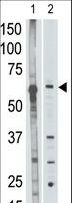 MMP25 / Leukolysin Antibody - The anti-MMP25 C-term Antibody is used in Western blot to detect MMP25 in mouse liver tissue lysate (lane 1) and HL60 cell lysate (lane 2) lysate.